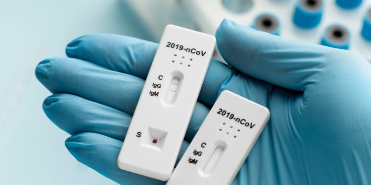 Drug Testing For Small Businesses